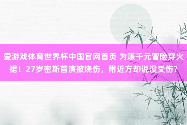 爱游戏体育世界杯中国官网首页 为赚千元冒险穿火裙!27岁密斯首演被烧伤,附近方却说没受伤?